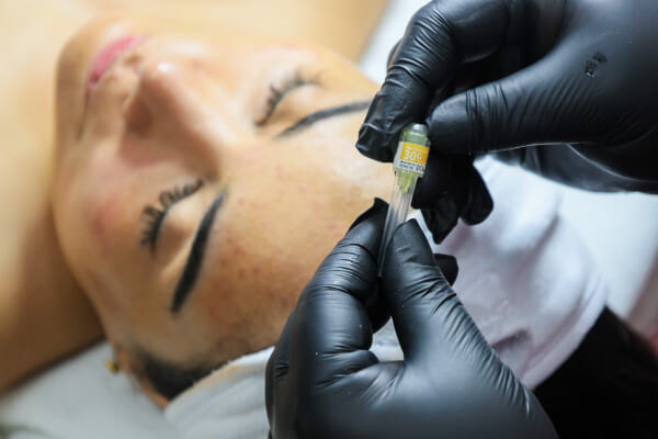 Professional injectable skincare product displayed at NOBU Escazú, a high-end Costa Rica esthetics salon and spa